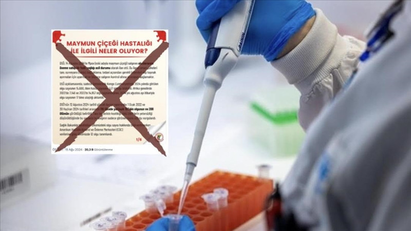 Maymun çiçeği virüsü nedir Maymun çiçeği virüsü nedir