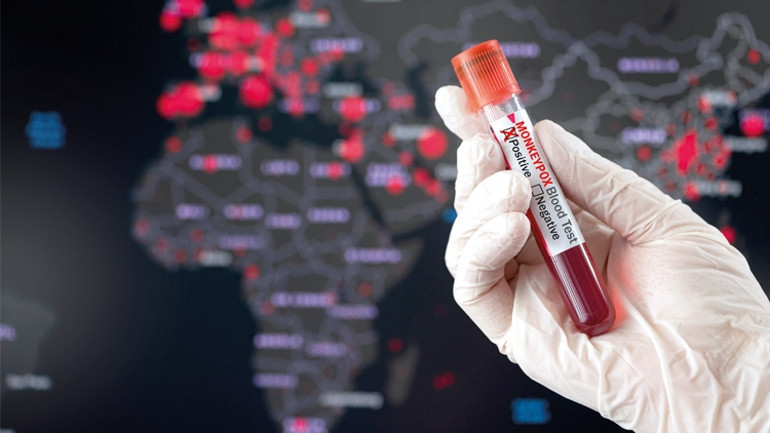 BELİRTİLERİ NELERDİR