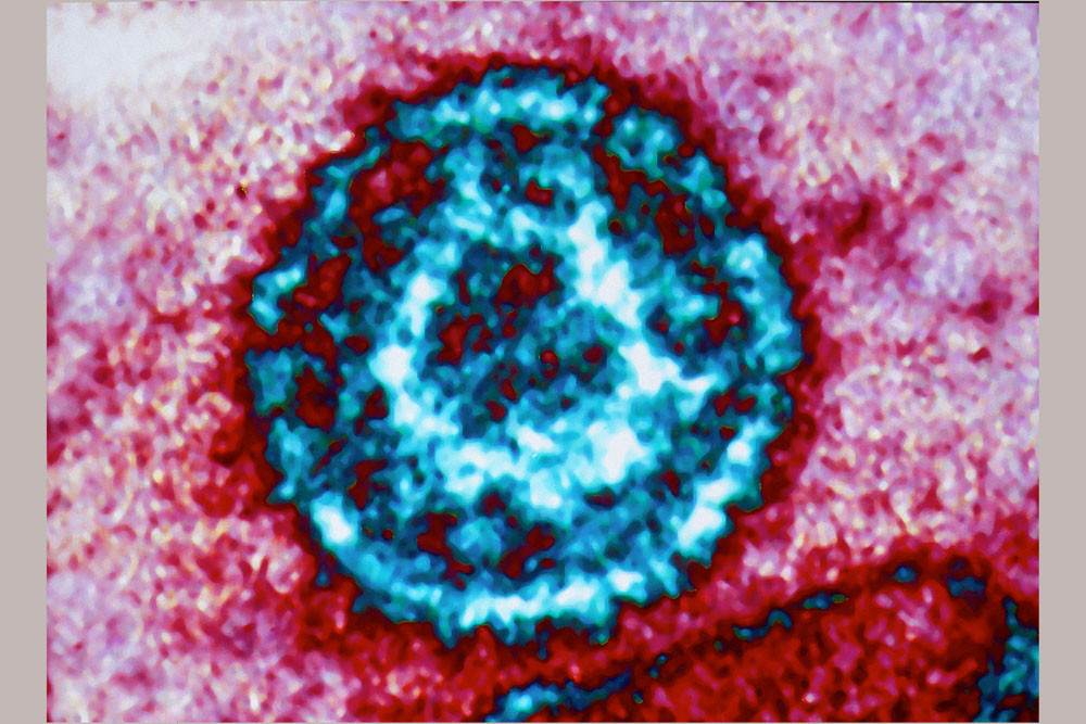 Bir aşı hayatınızı değiştirebilir HPV aşısı, birçok kanser türünün önüne geçiyor Bir aşı hayatınızı değiştirebilir HPV aşısı, birçok kanser türünün önüne geçiyor