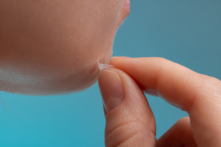 Söylenenler çok korkunç Ölüm üçgenindeki sivilceleri sıkmak tehlikeli mi Burada bir enfeksiyon oluşması halinde...