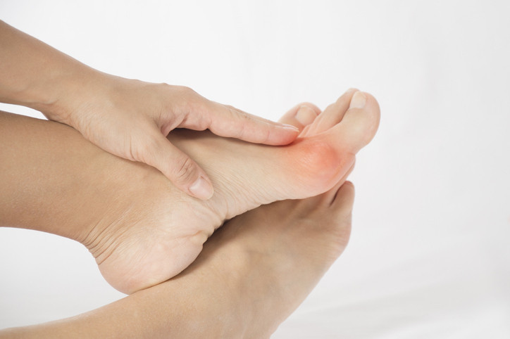 Halluks valgus belirtileri nelerdir 