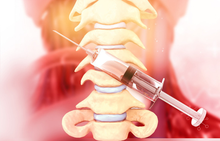 Osteoartrit (Kireçlenme) Osteoartrit (Kireçlenme)