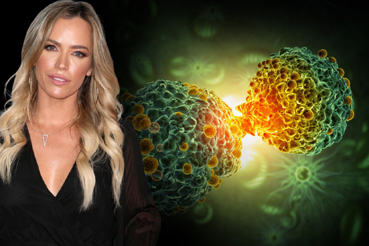 Ünlü yıldızın açıklamaları akıllara o ihtimali getirdi: Beyin tümörlerinin sebebi cilt kanseri olabilir mi Uzmanlar çok yaygın olduğu konusunda uyarıyor