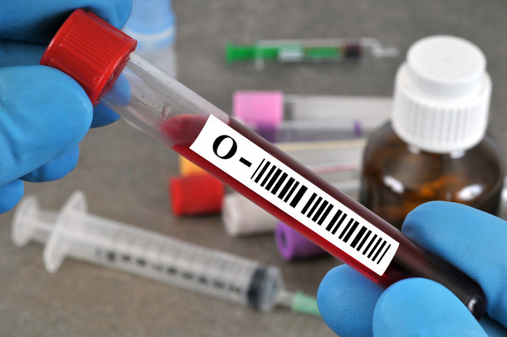 PEKİ BU NASIL OLUYOR