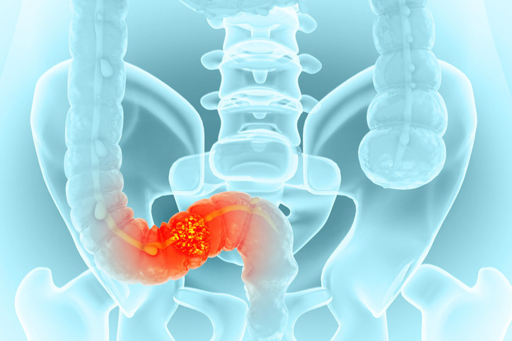HASTALIK RUHSAL SAĞLIĞI DA ETKİLİYOR