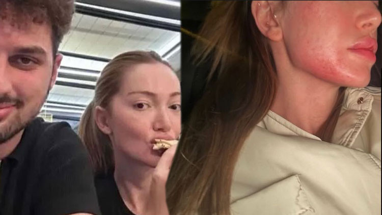 BERK ÇETİN YAKALANDI BERK ÇETİN YAKALANDI