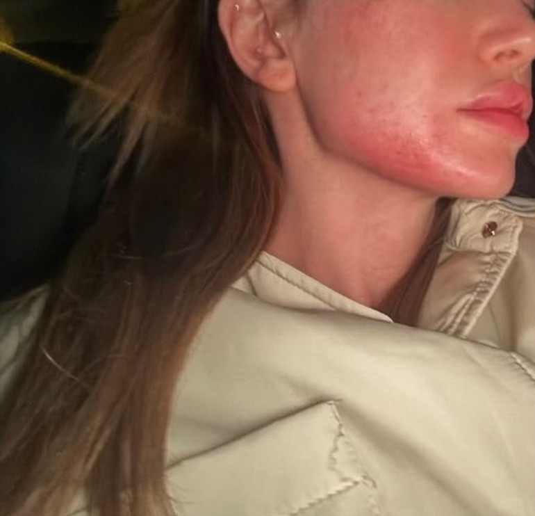 DARP İDDİALARINI REDDETTİ DARP İDDİALARINI REDDETTİ