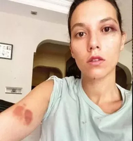 İDDİANAMEDEN DİKKAT ÇEKEN DETAYLAR