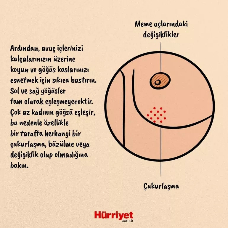 Evde bu muayeneyi yapın Doktoru en yaygın belirtilerden birini göz ardı etti, oysa bu, meme kanserinin işaretiydi