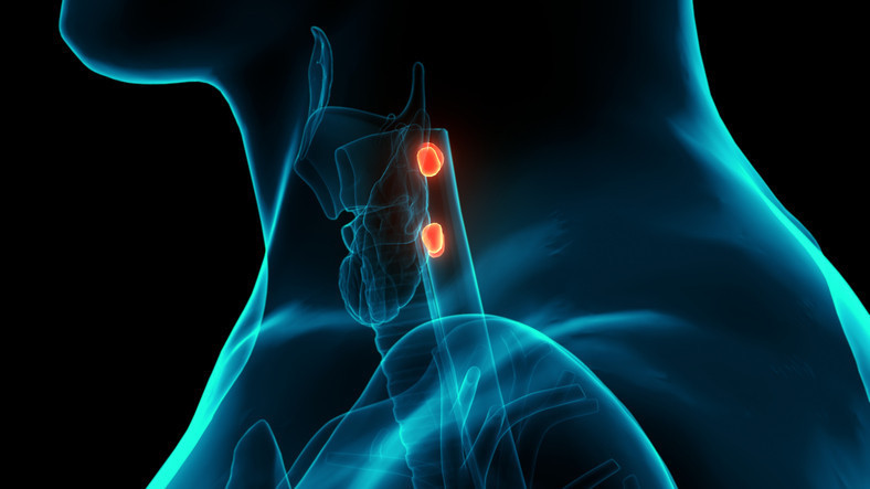 ŞİKAYETLER BİRÇOK HASTALIKLA KARIŞTIRILIYOR ŞİKAYETLER BİRÇOK HASTALIKLA KARIŞTIRILIYOR