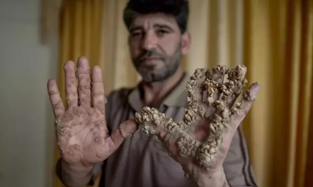 “ELLERİMİ KESİN” DİYE YALVARDI