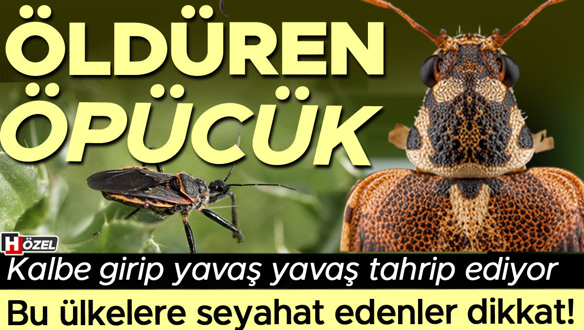 Öldüren öpücük: Yavaş yavaş kalbe girip tahrip ediyor! Chagas hastalığı bize de gelir mi? Bu ülkelere sehayat edenler dikkat!