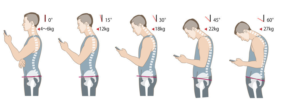 Omurlara 22 kg ekstra yük biniyor Gündüz yaptığınız bu hata gece sizi uykusuz bırakıyor Omurlara 22 kg ekstra yük biniyor Gündüz yaptığınız bu hata gece sizi uykusuz bırakıyor