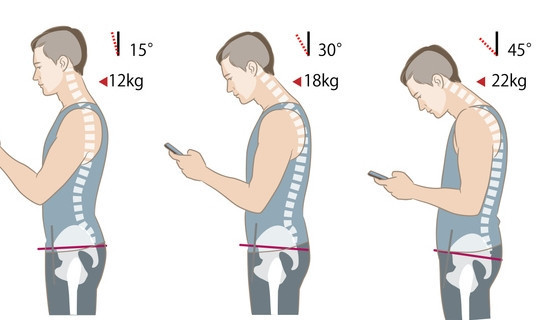 Omurlara 22 kg ekstra yük biniyor Gündüz yaptığınız bu hata gece sizi uykusuz bırakıyor Omurlara 22 kg ekstra yük biniyor Gündüz yaptığınız bu hata gece sizi uykusuz bırakıyor