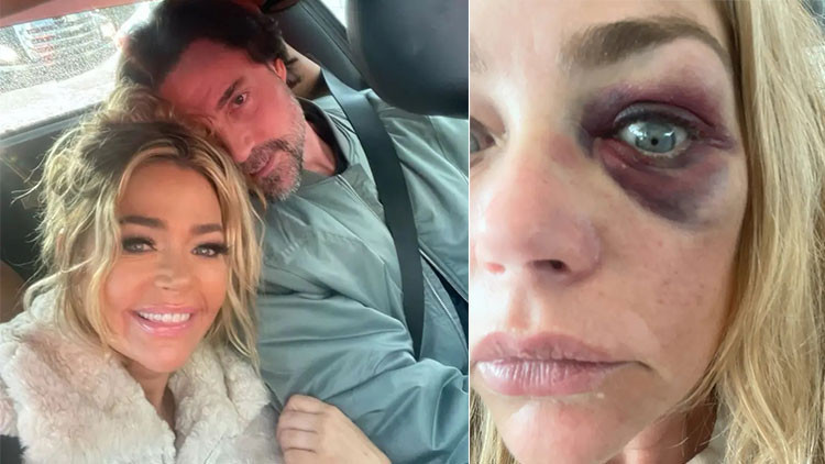 Ayrıldığı kocasından gördüğü şiddeti gözyaşlarıyla anlattı… ‘Beni hayat kadınlarıyla aldatan eşim hiç senin kadar alçalmadı!’