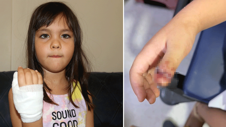 Antalya'da anaokulunda korkunç olay! 4 yaşındaki çocuğun parmağı, demir kapıya sıkışarak koptu