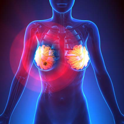 Vakaların yüzde 80’inde aile öyküsü yok, üstelik çoğu zaman ağrısız ortaya çıkıyor Meme sağlığı konusunda doğru bilinen yanlışlar