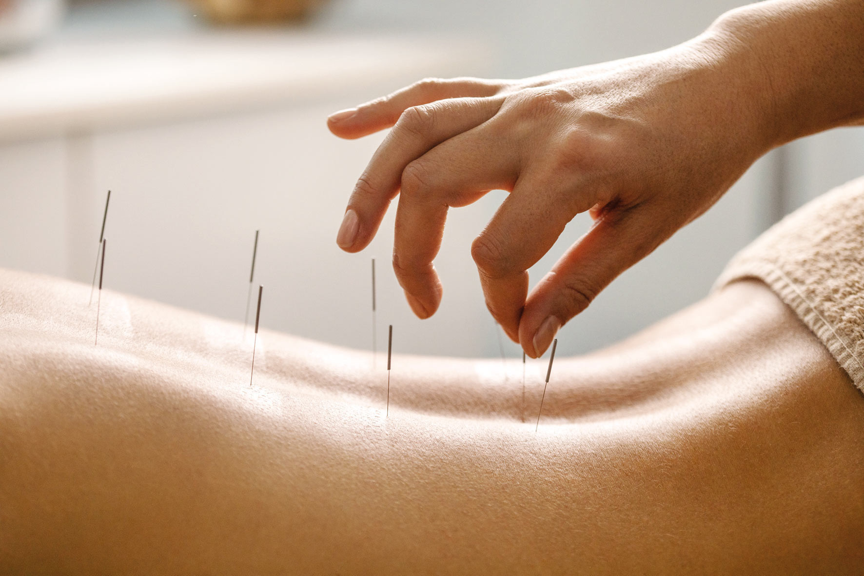 MS hastalarına akupunktur tedavisi