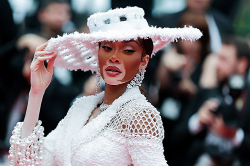 Alay edilen hastalığı onun şansı oldu... Şimdi büyük bir şöhreti ve bir sürü parası var... Yine kırmızı halının yıldızı oldu Alay edilen hastalığı onun şansı oldu... Şimdi büyük bir şöhreti ve bir sürü parası var... Yine kırmızı halının yıldızı oldu