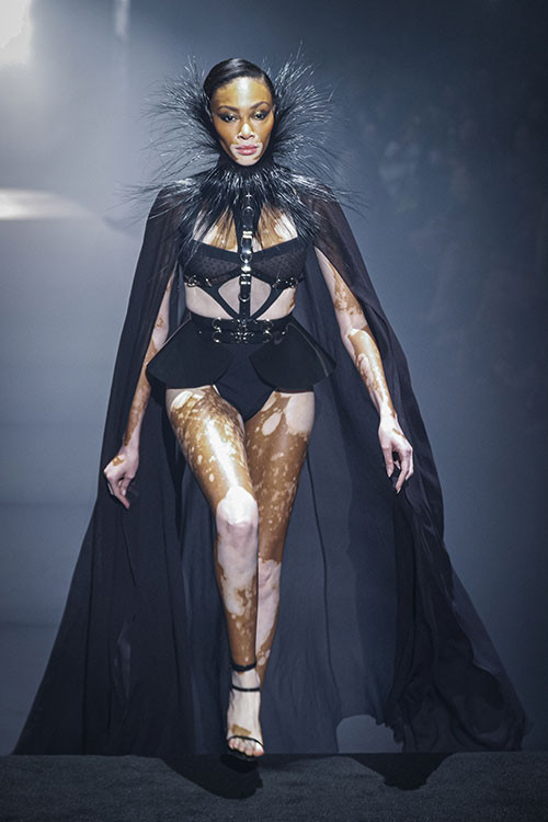 Alay edilen hastalığı onun şansı oldu... Şimdi büyük bir şöhreti ve bir sürü parası var... Yine kırmızı halının yıldızı oldu Alay edilen hastalığı onun şansı oldu... Şimdi büyük bir şöhreti ve bir sürü parası var... Yine kırmızı halının yıldızı oldu