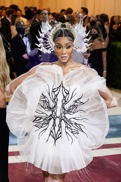 Alay edilen hastalığı onun şansı oldu... Şimdi büyük bir şöhreti ve bir sürü parası var... Yine kırmızı halının yıldızı oldu Alay edilen hastalığı onun şansı oldu... Şimdi büyük bir şöhreti ve bir sürü parası var... Yine kırmızı halının yıldızı oldu