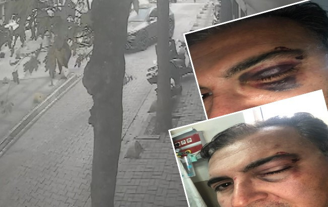 Sokakta kedi besleyen iş insanına güpegündüz saldırı