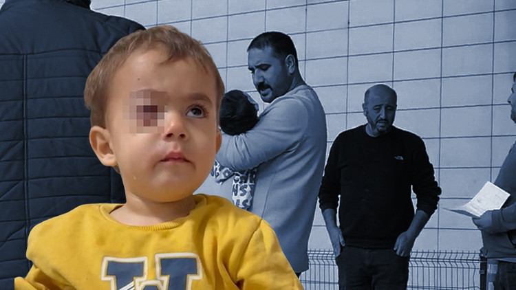 Baba, fırıncıyı daha önce uyarmış! 2 yaşındaki Alpaslan gözünü kaybetti