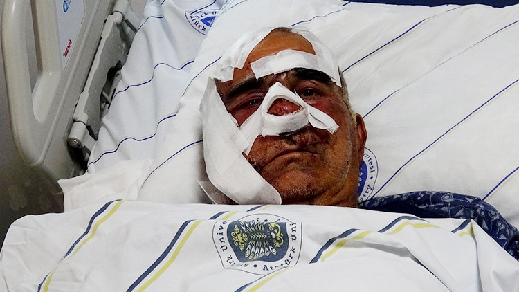 Köyde 5. kez aynı kabus! Yaşlı adama saldırdı, pençe darbeleriyle yüzündeki kemiği kopardı