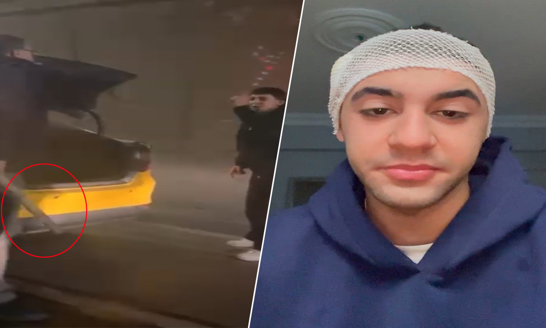 Tartışmaya girdiği taksicisi, motosiklet sürücüsünü sopayla yaraladı