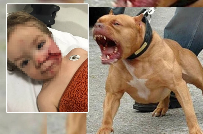 Ankara'da pitbull dehşeti: Çocuğun yüzü paramparça oldu