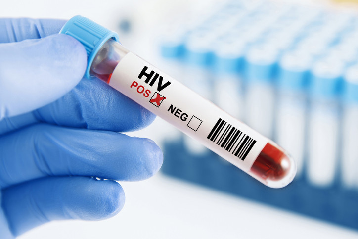 HIV pozitif biriyle cinsel ilişkiye girmek tamamen güvensiz midir