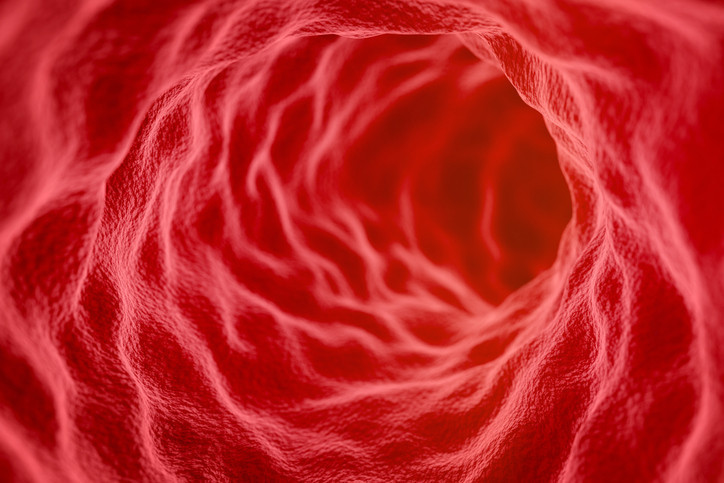 Ağrısız gelişiyor, sinsice ilerliyor Murat Cemcir’i yoğun bakımlık eden hastalık divertikül kanaması