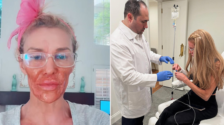 Ünlü yıldızın yüzü erimeye başlamıştı... Binlerce dolar harcadı, gerçeği buldu: Sonunda teşhis konuldu