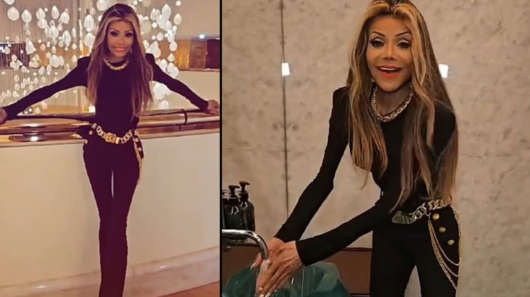 Ünlü şarkıcı koptu kopacak: Bakın işinize ben iyiyim!