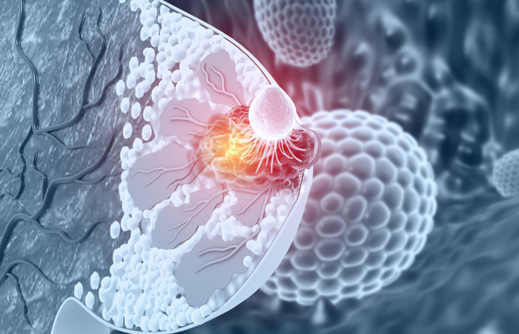 Sağlıklı diye tüketiyoruz ama... Bu gıdalar meme kanseri riskini artıyor olabilir