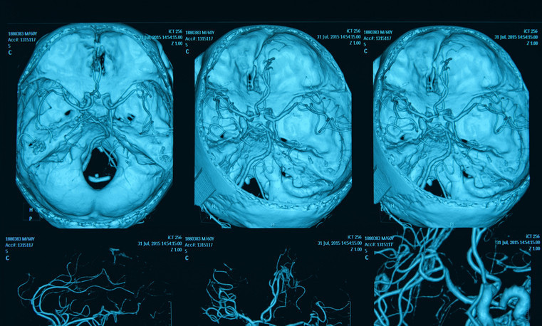 Günde 10.000 kalori tüketirseniz ne olur Ünlü influencer bunu yapmayı denedi, sonucu korkunç oldu