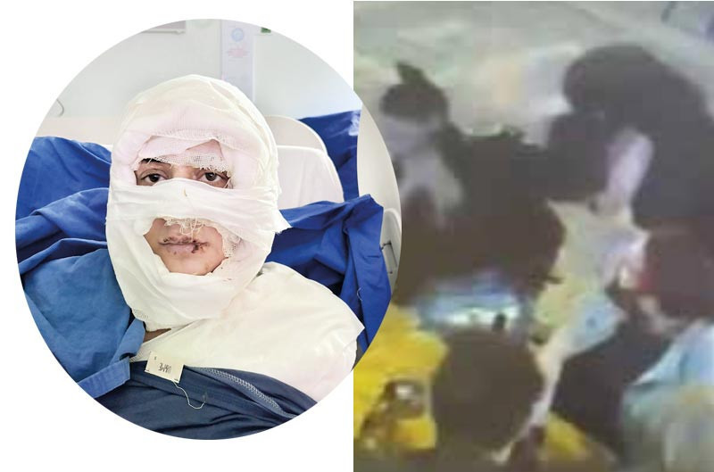 Kıskançlık ateşine 4.5 yıl istendi