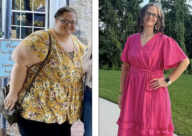 Ortaya çıkan sonuç inanılmaz: İğne ile kilo vermek mi, cerrahi müdahale mi? Araştırma çarpıcı farkı ortaya koydu...