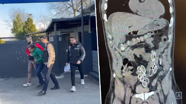 Fas'tan Türkiye'ye midesinde getirdi! Ameliyatla çıkarıldıktan sonra tutuklandı