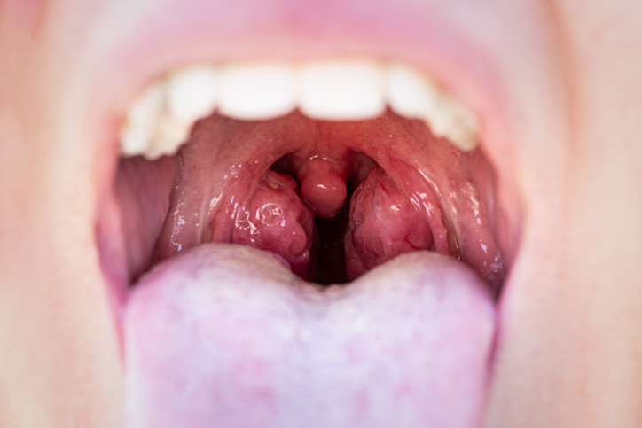 GİZLİ SEBEP GİZLİ SEBEP