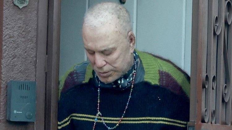 Şöhret kuyusunun karanlığı onu da yuttu... Hem parası gitti hem yakışıklılığı... Alay etmesinler diye peruk takıyormuş!