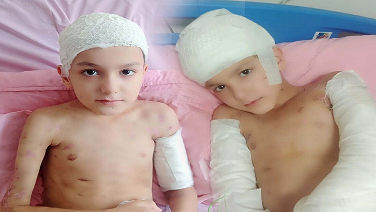 12 yaşındaki Tunahan'ın hayatını kabusa döndü! Sokak köpeği saldırısında aileye 5 milyon lira tazminat ödenecek