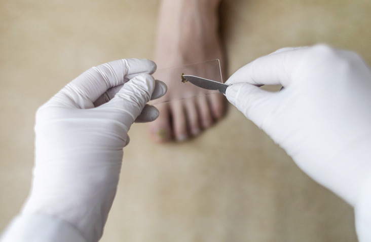 Tırnaklarının fotoğrafını gören herkes Hemen doktora git dedi Bu uyarının sebebi neydi