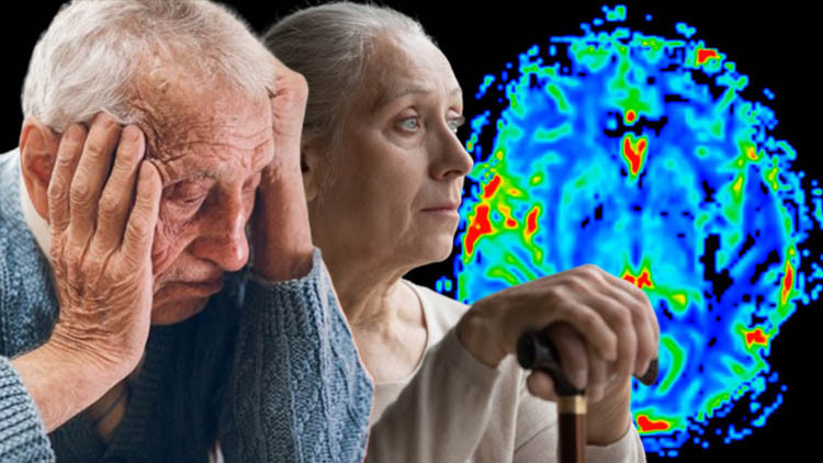Virüsü atlattınız ama zihniniz tehlikede olabilir! Bilim insanlarından korkutan Alzheimer uyarısı | BU BELİRTİLERE DİKKAT