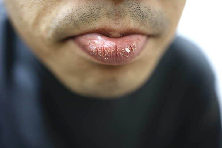 EV YAPIMI ÇÖZÜMLER RİSKLİ OLABİLİR EV YAPIMI ÇÖZÜMLER RİSKLİ OLABİLİR