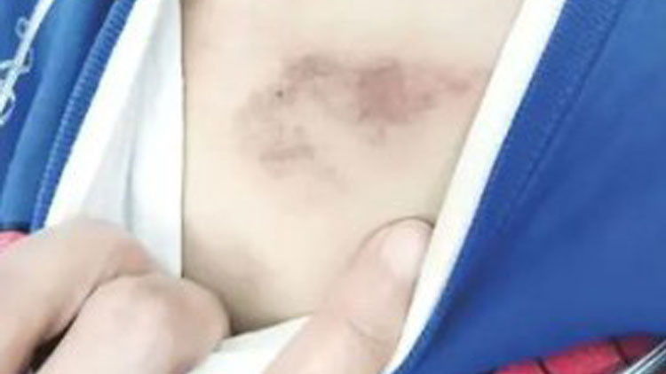 İBB'ye bağlı kreşte şiddet iddiası... Aile ve Sosyal Hizmetler Bakanlığı çalışma başlattı