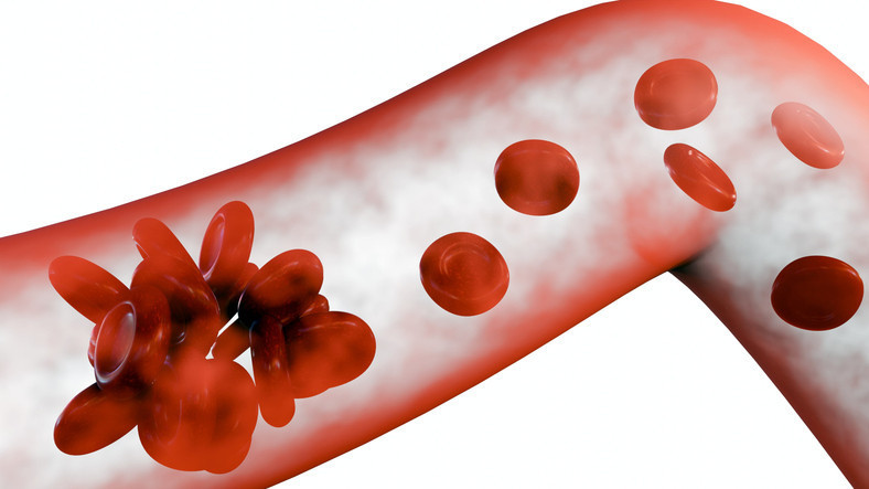  50 yaş üzerindeki herkes kan sulandırıcı içmeli mi