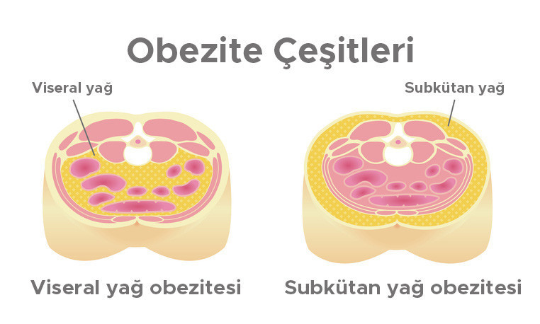  Metabolik sağlık ne demek
