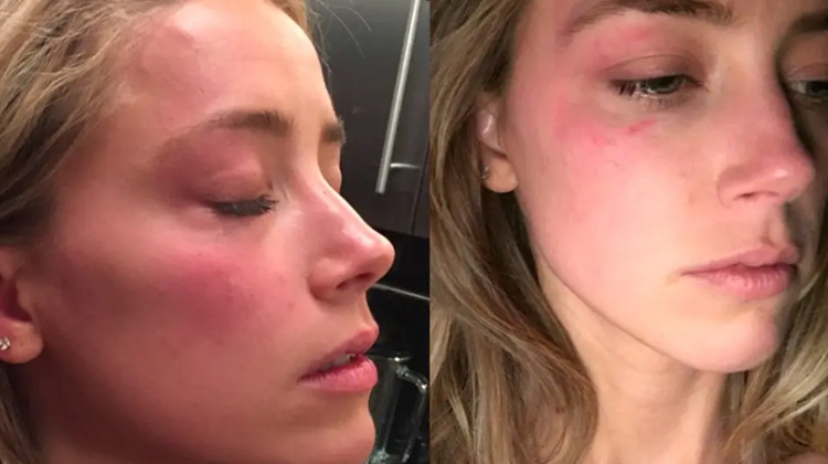 Büyük aşkla evlendiği kocasından şiddet görünce boşanmıştı... 'Konuşma yeteneğimi kaybettim... Hikayemi anlatmak istemiyorum'