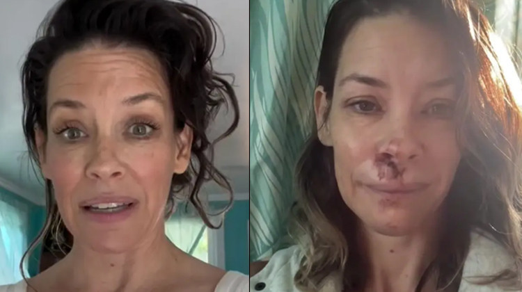 Ünlü oyuncu emekliliğin keyfini bile süremedi... 'Beyin sarsıntısı geçirdim... İyileşmek için çok para harcadım'